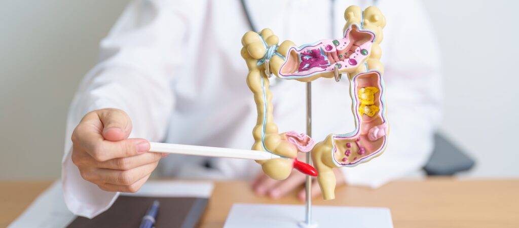 Colon Cancer Specialist in Mumbai