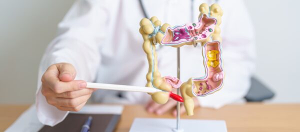 Colon Cancer Specialist in Mumbai