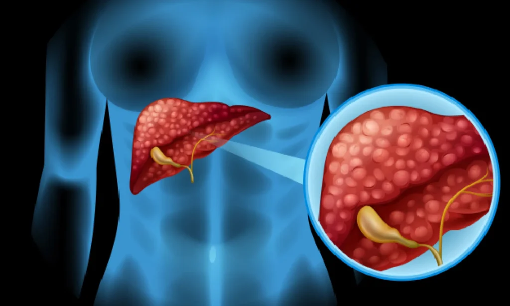 lung cancer specialist in mumbai