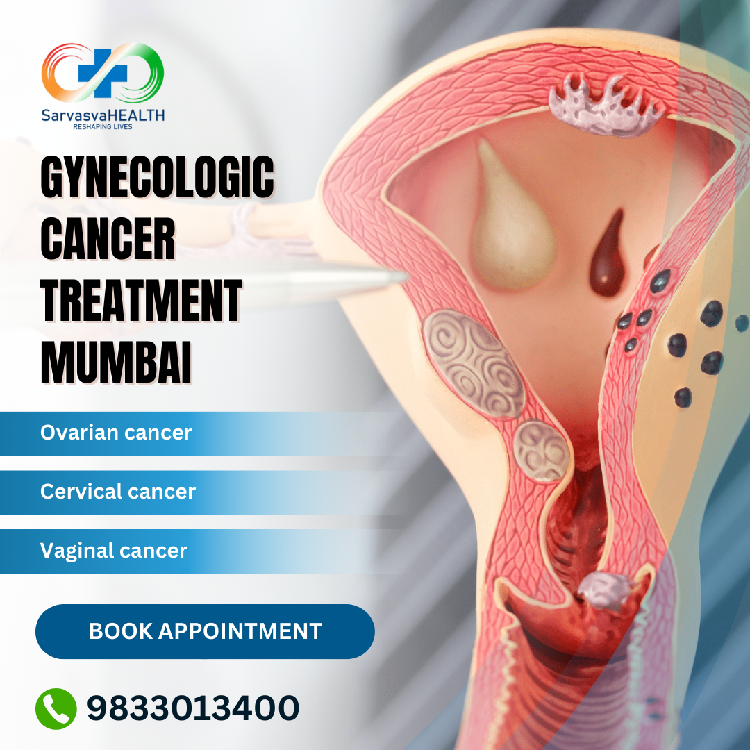 Gynecologic Cancer Treatment Mumbai: Treatment Options & Patient Outcomes
